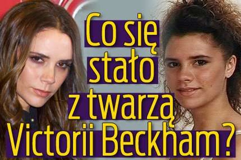 Co się stało z twarzą Victorii Beckham?