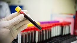 ¿Cómo prepararse para las pruebas hepáticas?  Empezar una semana antes de la prueba.