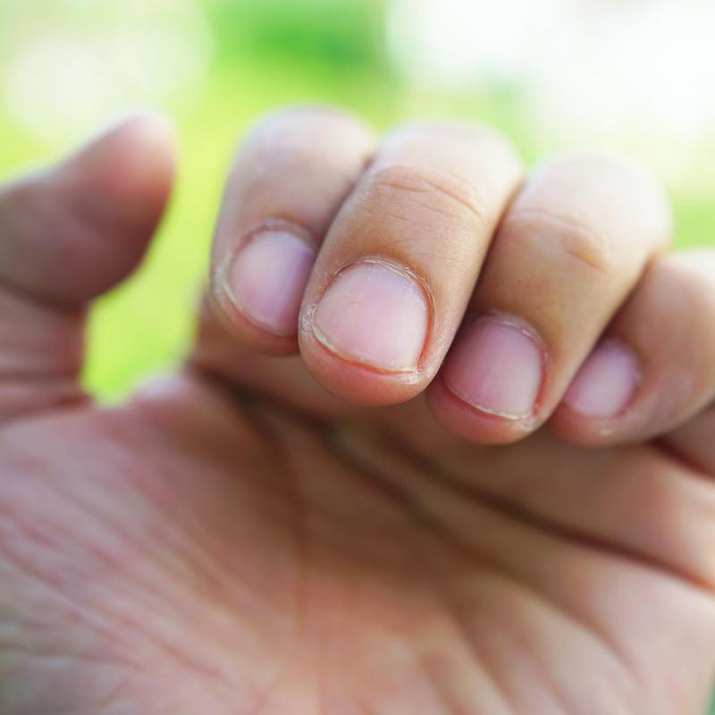 Diagnoza z paznokci. O jakich chorobach możemy się dowiedzieć?