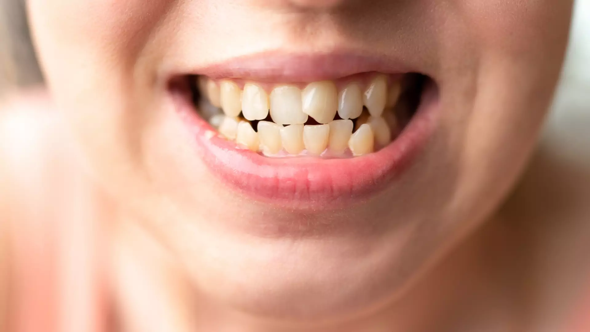 Sennik: zęby. Czy sen o zębach to zła wróżba? Poznaj jego znaczenie