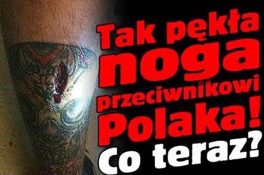 Tak pękła noga przeciwnikowi Polaka! Co teraz?