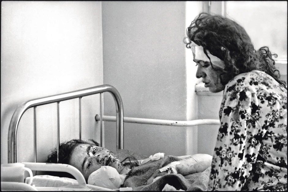 Albanske žene u bolnici pošto je NATO pogodio njihovu izbegličku kolonu