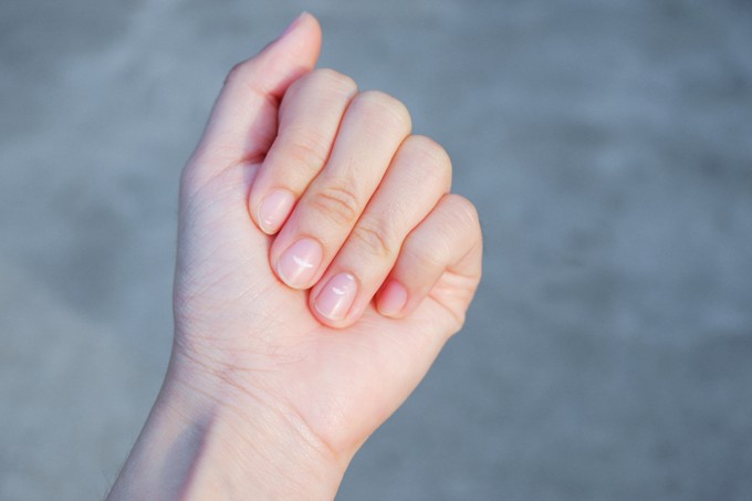 Így jelzi a körme utólag is, ha koronavírus fertőzött volt