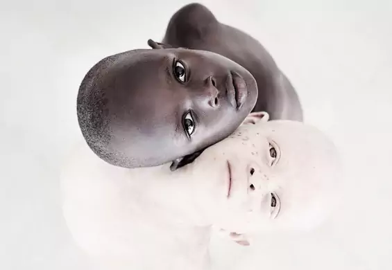 Mamy 2017 rok, a łowcy dzieci wciąż wierzą, że albinosi to dzieło diabła