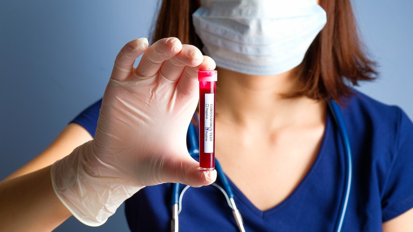 Testiranje na korona virus nije moguće kod privatnika