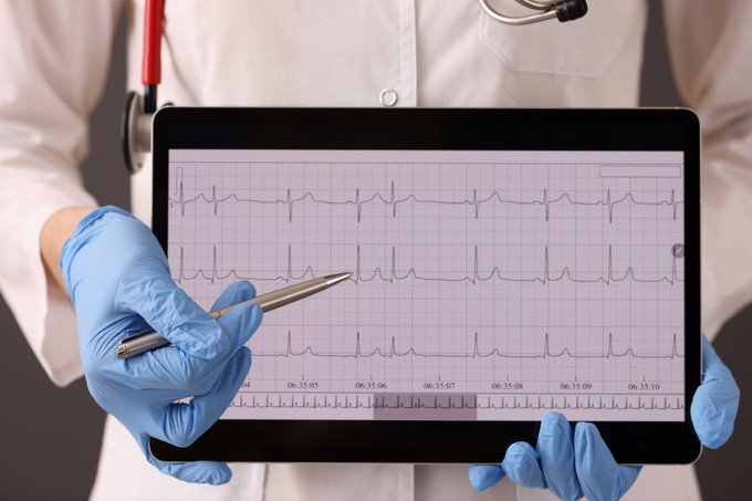 Mi az EKG és mit mutat ki?