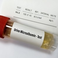 Mit jelent a vizelet mikroalbumin érték a laborleleten?