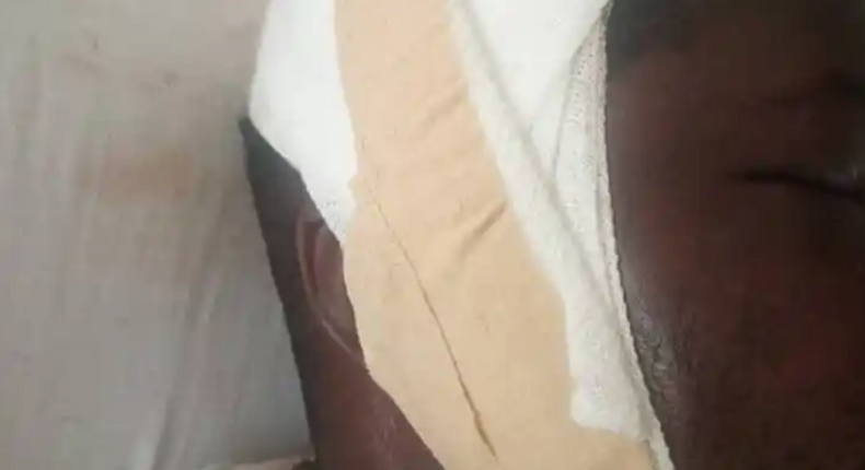 Man brutally beaten over alleged disappearance of Okada rider's penis at Senya Bereku