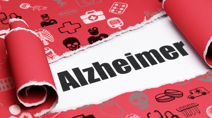 Ha a beteg hosszú idővel a tünetek megjelenése előtt megismeri a kockázati szintjét, akkor rengeteg időt kap arra, hogy elkezdjen pozitív életmódbeli változtatásokat végrehajtani, és olyan gyógyszeres stratégiákat alkalmazzon, amelyek segíthetnek lassítani az Alzheimer-kór előrehaladását. / Kép: NorthFoto