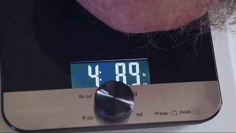 Tumor koji je Tim imao godinama na licu