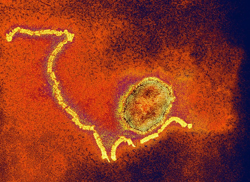 Wraca śmiertelna epidemia naszego dzieciństwa. Są ofiary