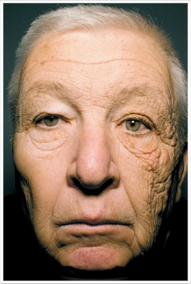 Foto: New England Journal of Medicine