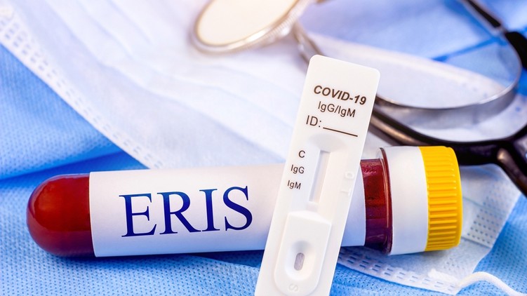 Eris, koronavírus,  omikron muráns, vírus fertőzés tünetei jelei