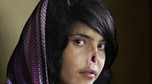 Bibi Aisha (na zdjęciu autorstwa Jodi Bieber z RPA, która za tę fotografie otrzymała nagrodę World Press Photo 2010), fot. Reuters