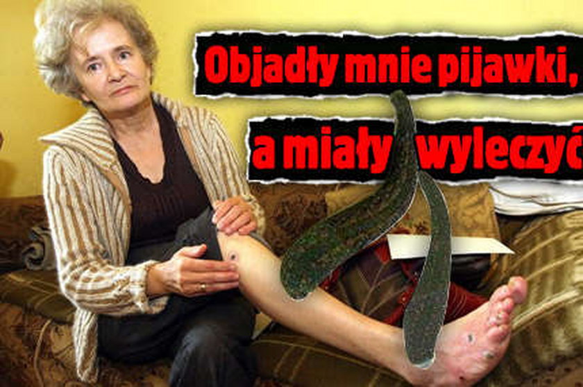 Objadły mnie pijawki, a miały wyleczyć