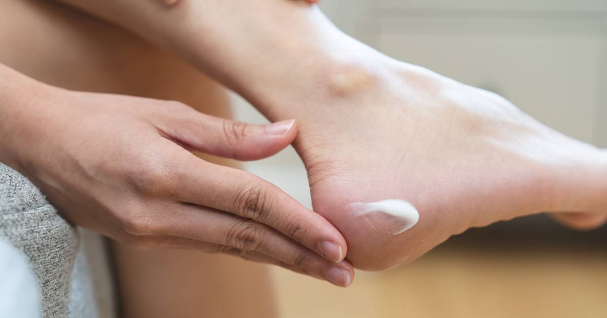 Ta maść za 8zł z witaminą A pomoże na zrogowaciałe stopy, suche dłonie i ukoi podrażnienia