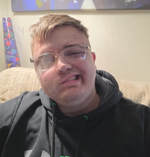 Michael dúfa, že mu liečba pomôže.