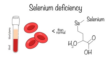 Szelénhiány tünetei, vizsgálata és kezelési lehetőségei