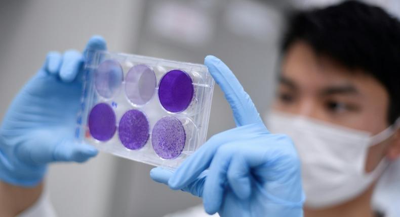 The leaders for two of the most advanced coronavirus vaccine projects -- Oxford University, in partnership with AstraZeneca labs, and China's Sinovac -- will carry out clinical testing in Brazil