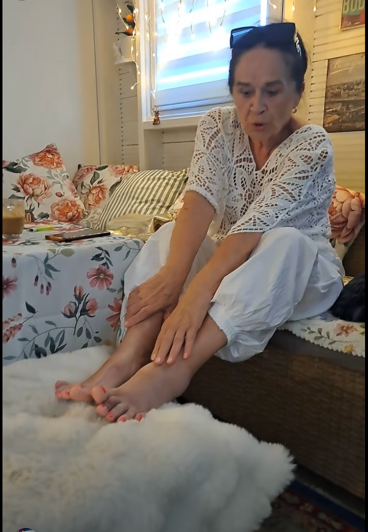 Slovenská herečka Hana Gregorová ukázala zranenie nohy. 