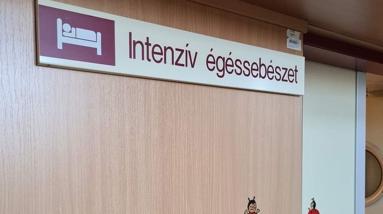 intenzív égéssebészet, áramütés, vonat, baleset