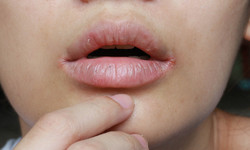 Objawy niedoboru tej witaminy widać na ustach i twarzy. Sygnały, że musisz uzupełnić braki