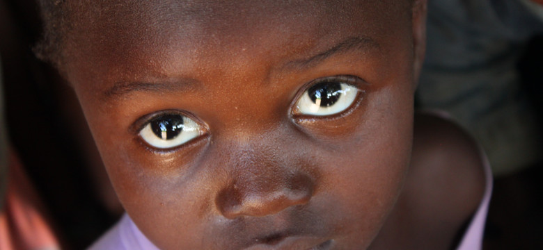 Mieszkańcy Sierra Leone nadal potrzebują pomocy