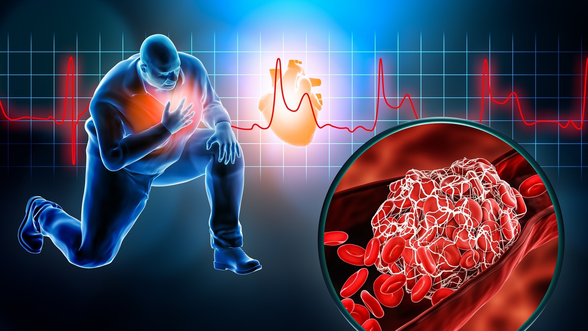  Kardiovaskularne bolesti vodeći su uzrok smrti kod osoba sa gojaznošću