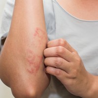 Ezt jelzi, ha érme alakú, viszkető foltok jönnek ki a kezén, lábán