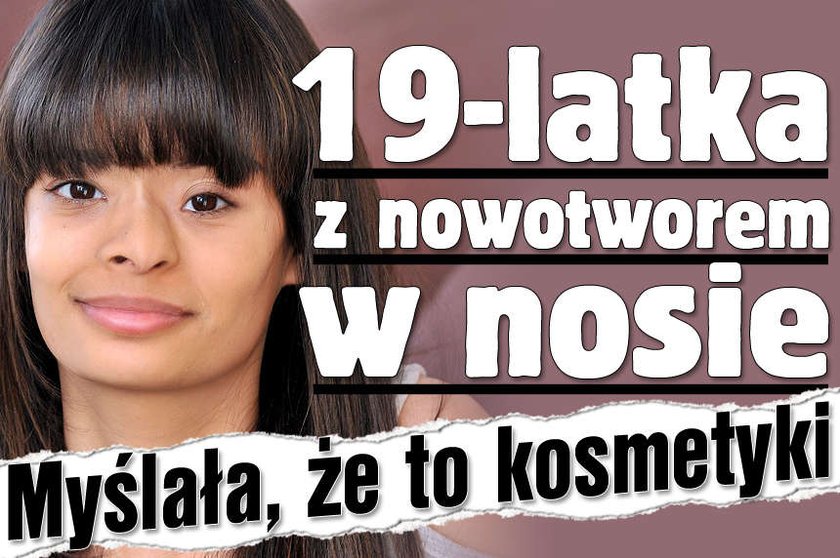 19-latka z nowotworem w nosie. Myślała, że to kosmetyki