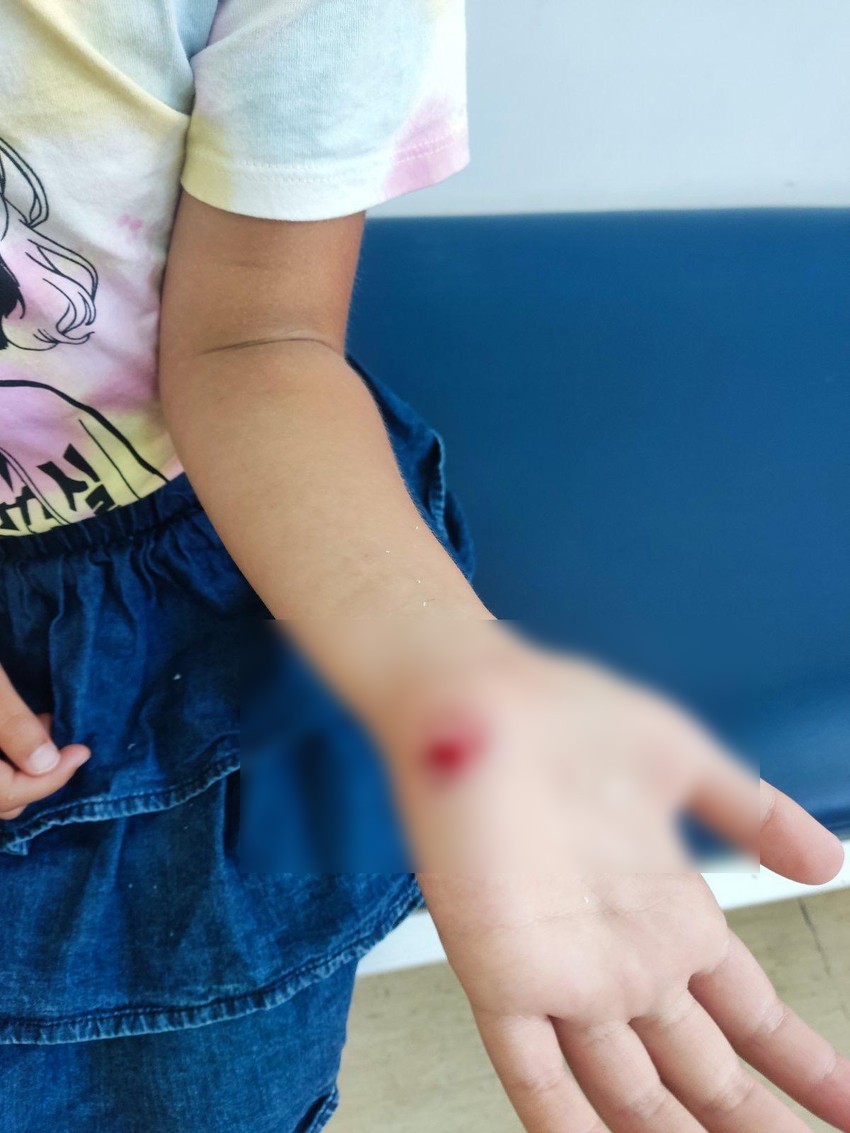 Devojčicu su roditelji odmah odveli na lekarski pregled