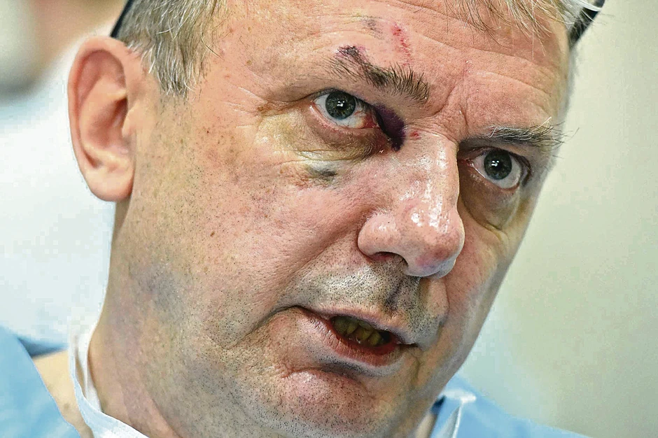 Rade Marković nedugo posle incidenta