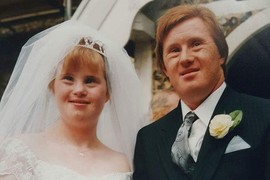 Moja sestra se 1995. udala, I ONA I MUŽ IMAJU DAUNOV SINDROM: Svi su nam govorili da je to odvratno i da TREBA ZABRANITI VENČANJE, a evo kako je izgledalo 26 godina njihovog braka