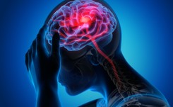 Nadciśnienie odpowiada za ponad połowę udarów mózgu. Jak temu zapobiec?