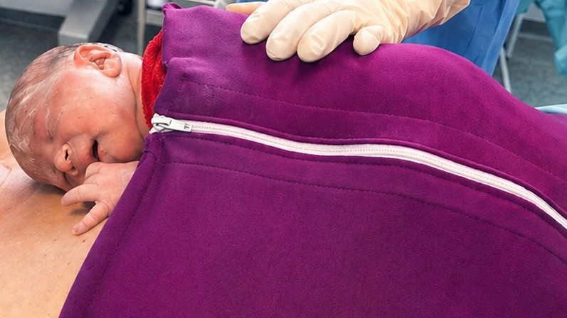 Nepretržitý bonding po cisárskom reze v celkovej anestézii zažila mamička Lenka v bardejovskej pôrodnici. @Nemocnica sv. Jakuba, n.o., Bardejov, partner skupiny AGEL