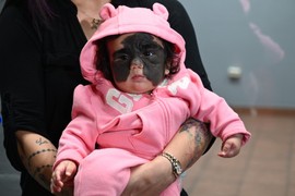 Luna Fener, devojčica sa maskom Betmena, nakon poslednje operacije ne prestaje da se gleda u ogledalu
