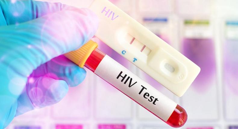 HIV test