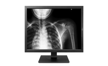 monitor2-ek