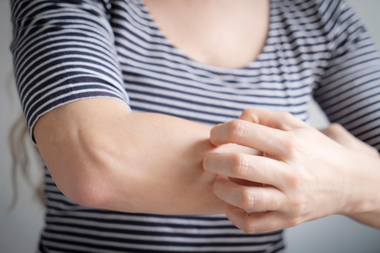 Svrbenie pokožky sa spája s viacerými typmi rakoviny. (ilustračné foto)