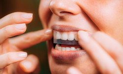 Jak wybielić zęby w domu? To radzi dentystka