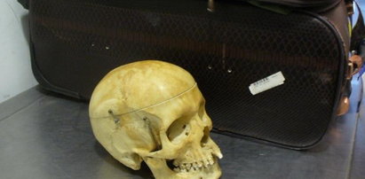 Celnicy z Goleniowa znaleźli ludzką czaszkę w walizce