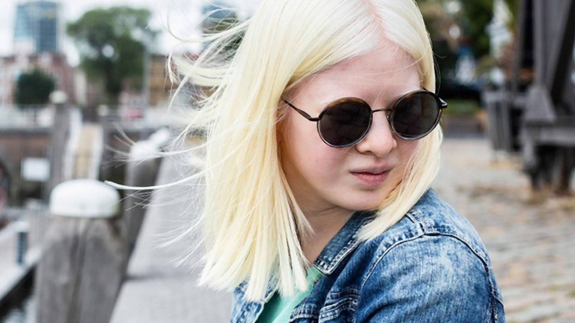 Roditelji su mislili da je prokleta zato što je rođena kao albino i ostavili je ispred sirotišta, a danas pozira za Vogue