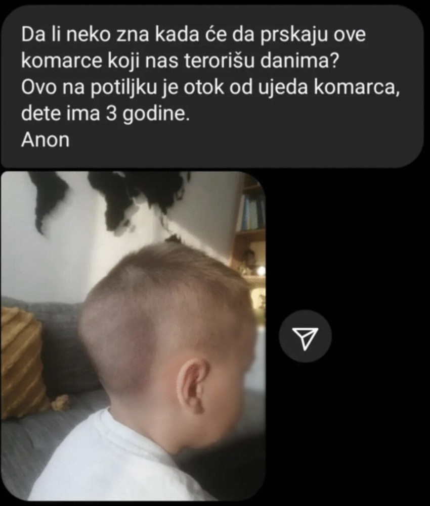 Detetu se nakon ujeda komarca deformisala glava