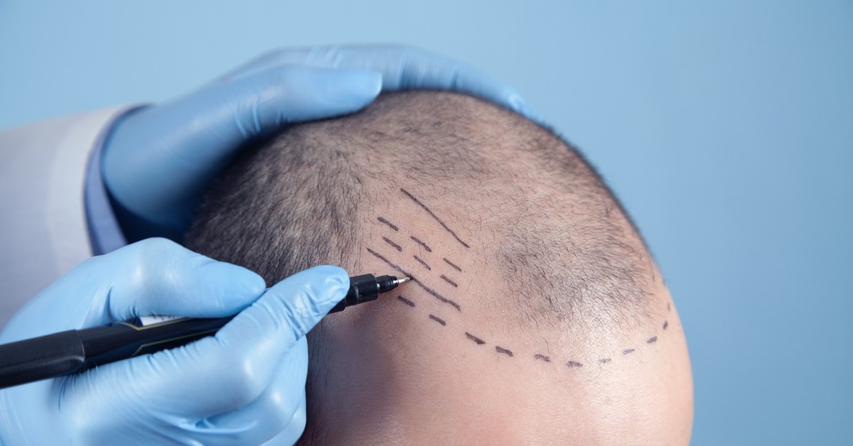 Czy usługi trychologa są z VAT?