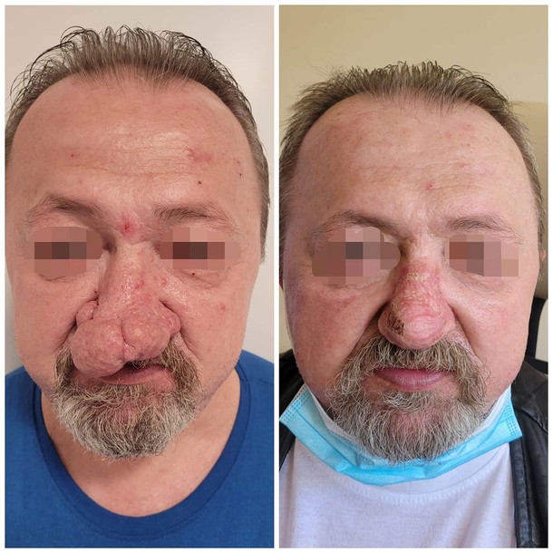 Moja specjalizacja dotyczy najbardziej widocznego obszaru ludzkiej tożsamości: nosa i skóry twarzy – dr n. med. Piotr Rot.