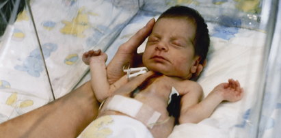 Przeszczepili niemowlęciu serce pawiana. Rodzice wyrazili na to zgodę, a dziewczynka walczyła o życie 20 dni