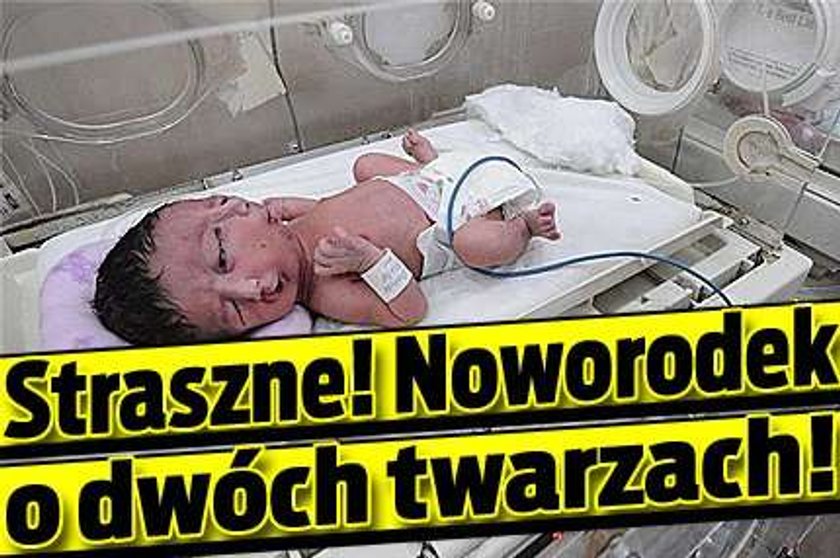 Straszne! Noworodek o dwóch twarzach!