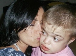 Arłukowicz skaże dzieci na cierpienie? Walka o lek dla chorych na zespół Huntera