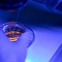 Mire jó a biopszia? Ha egy ilyen vizsgálat után visszahívják, még nem feltétlen jelent rákot