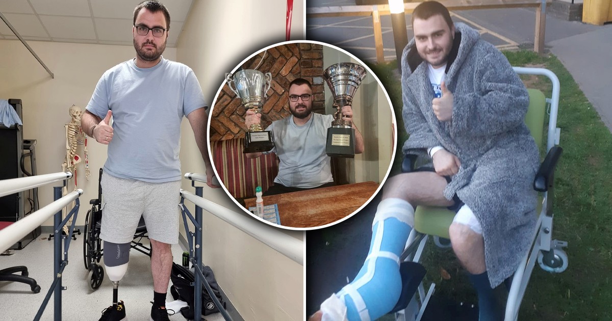 Chciał milion funtów odszkodowania. Niewiarygodne, co zrobił ze swoją nogą